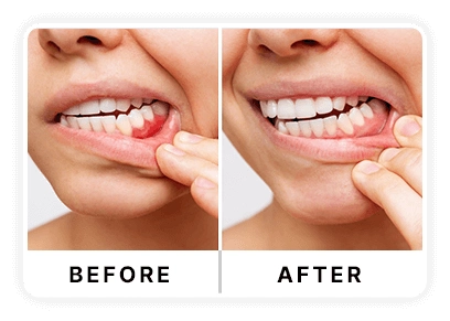 Benefits of DentaVive